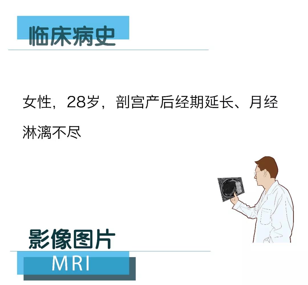【朗润影像档案】20180309磁共振影像病例结果讨论