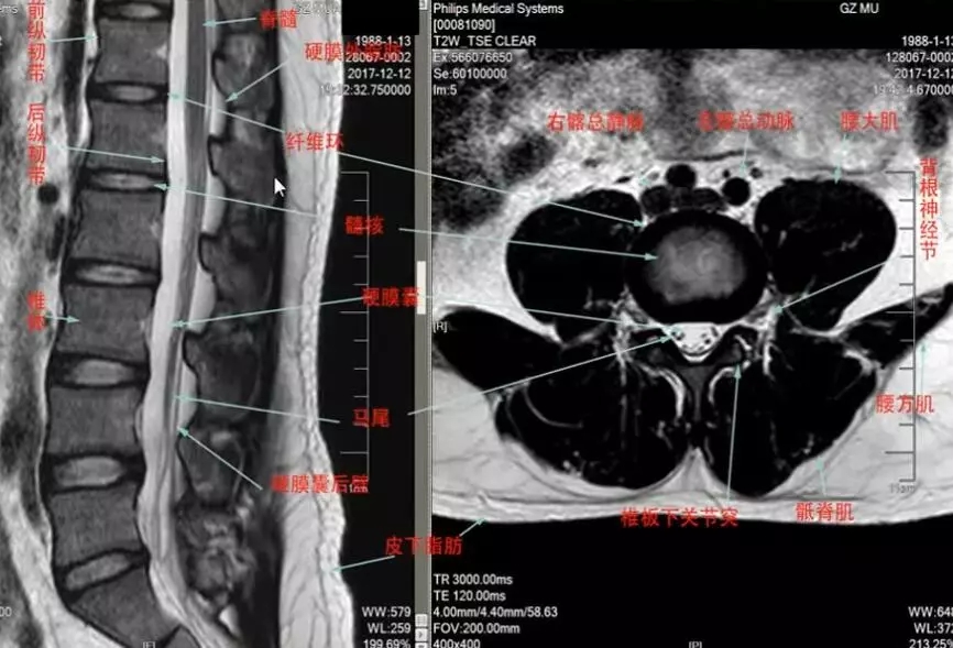 1550475892589588.jpg 1550475892589588.jpg