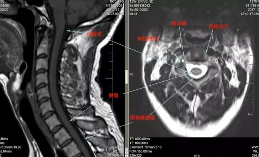 1550475925229417.jpg 1550475925229417.jpg