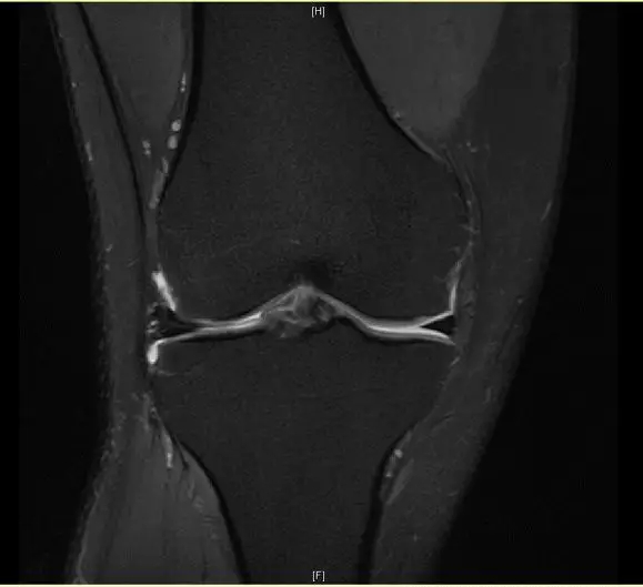 1550556419627271.jpg 1550556419627271.jpg