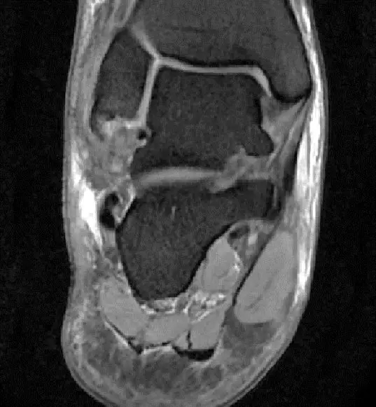 1550557247294714.jpg 1550557247294714.jpg