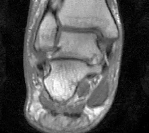 1550557313982900.jpg 1550557313982900.jpg