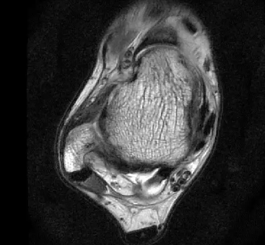 1550557881180004.jpg 1550557881180004.jpg