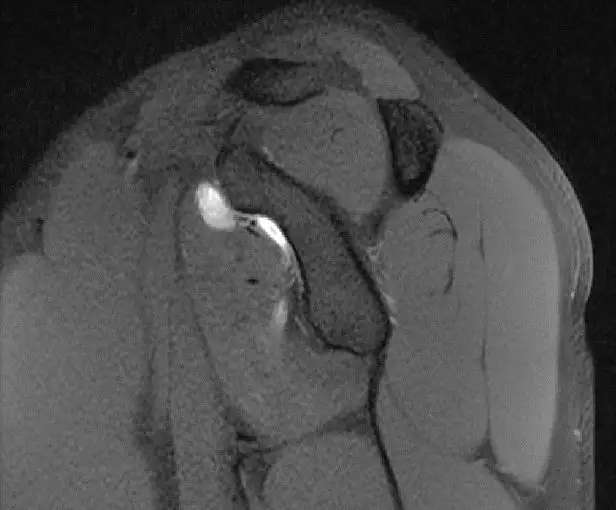 1550558993674764.jpg 1550558993674764.jpg