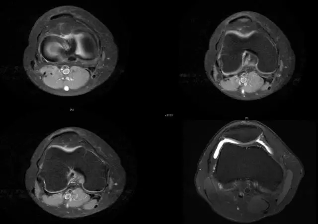 1550564136206834.jpg 1550564136206834.jpg