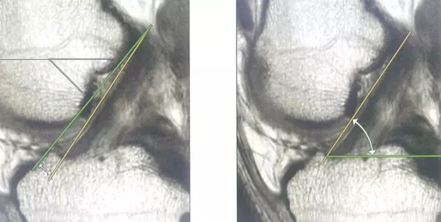 1550648856606543.jpg 640.webp (20).jpg