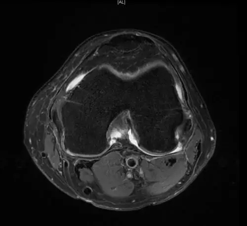 1551057953791982.jpg 1551057953791982.jpg