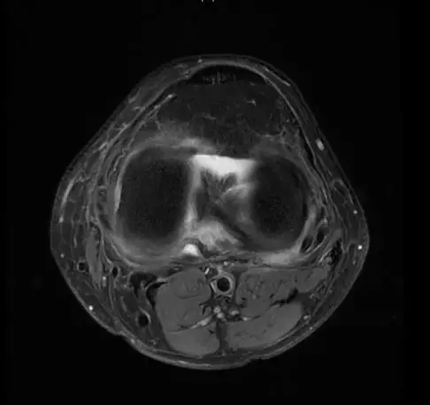 1551057999196678.jpg 1551057999196678.jpg