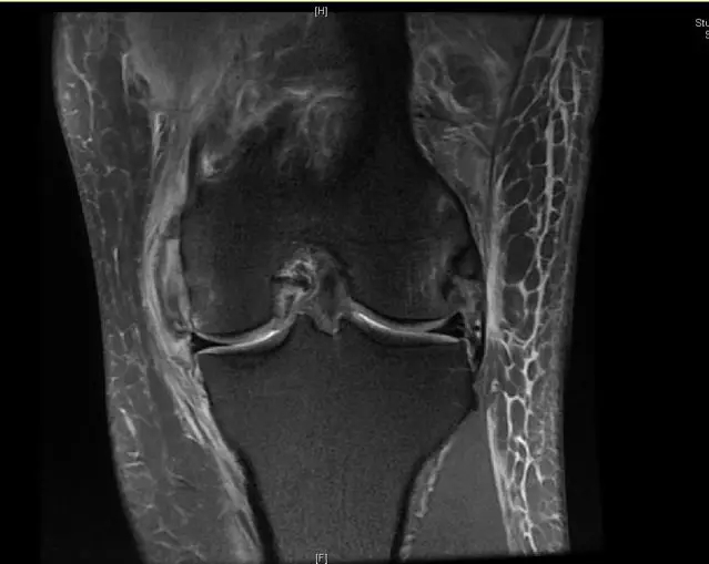 1551059596219551.jpg 1551059596219551.jpg