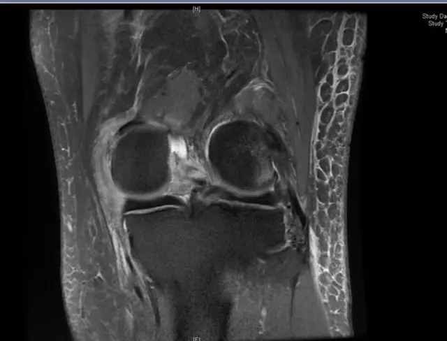 1551059614161183.jpg 1551059614161183.jpg