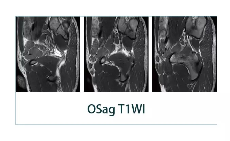 【朗润影像档案】磁共振影像病例分享(编号20190405)