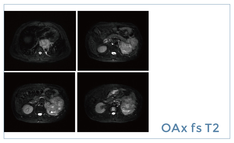 【朗润影像档案】磁共振影像病例分享(编号20190426)