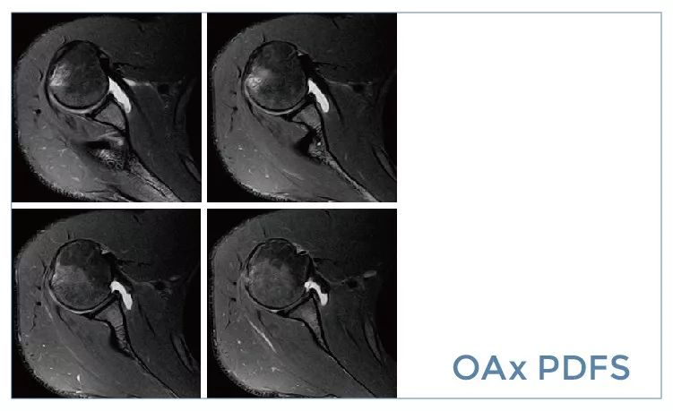 【朗润影像档案】磁共振影像病例分享(编号20190927)