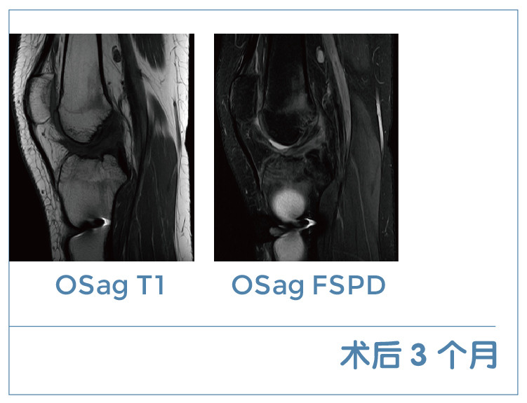 【朗润影像档案】磁共振影像病例分享(编号20200306)